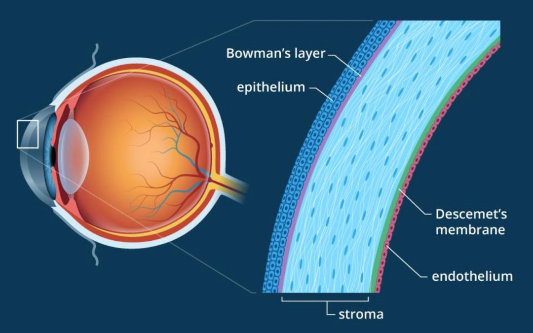 Revolutionising treatment of Fuchs’ Endothelial Dystrophy: Can corneal transplant be avoided?